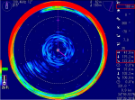 Spear squids at the sea bottom at 130.4 kHz